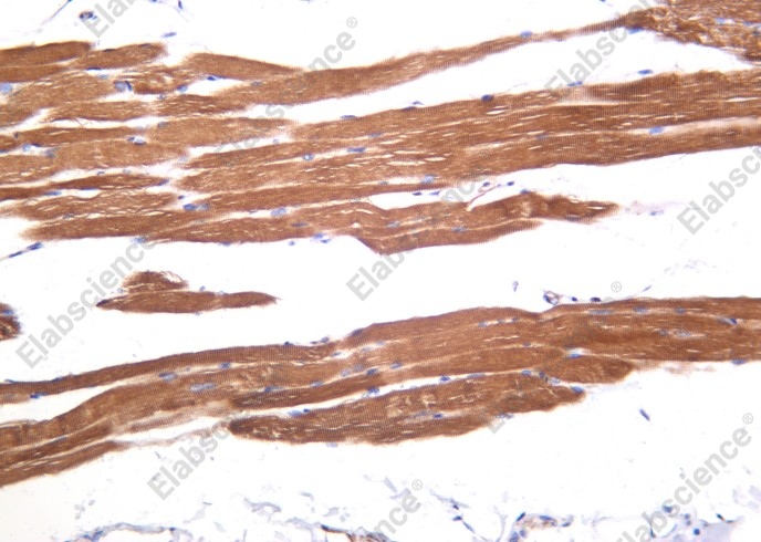 Recombinant LOX Monoclonal Antibody - 2
