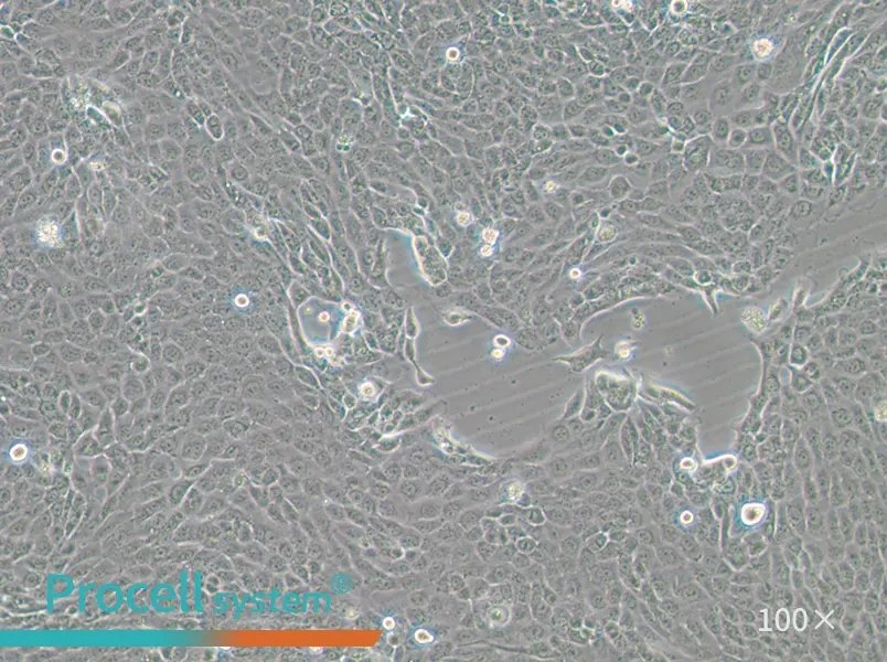 CFPAC-1 Cell Complete Medium - 2
