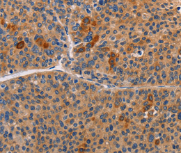ALDH3A1 Polyclonal Antibody - 3