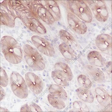 Recombinant FGFR2 Monoclonal Antibody - 2