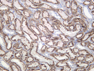 Recombinant Arginase II Monoclonal Antibody - 2
