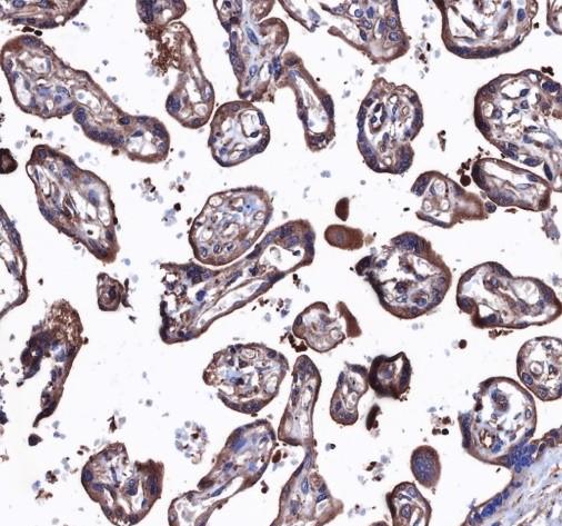 Recombinant Bcr Monoclonal Antibody - small - 4