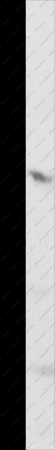 GNAS Polyclonal Antibody - 1