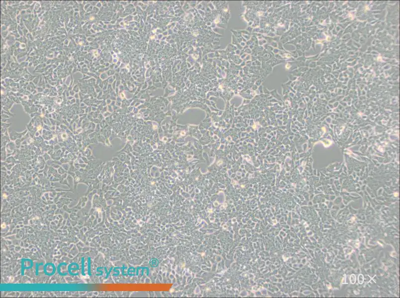 HCT 116 Cell Complete Medium - 1