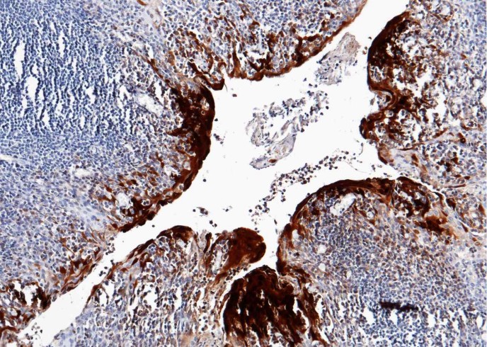 Recombinant S100A7 Monoclonal Antibody-searchlist-1