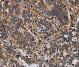 FLNA Polyclonal Antibody - 2