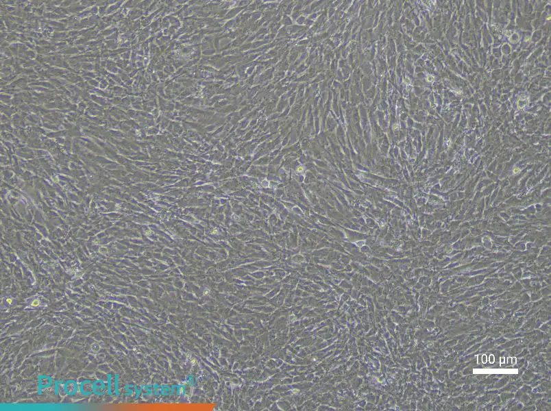 Rabbit Aortic Smooth Muscle Cell Complete Medium - 1