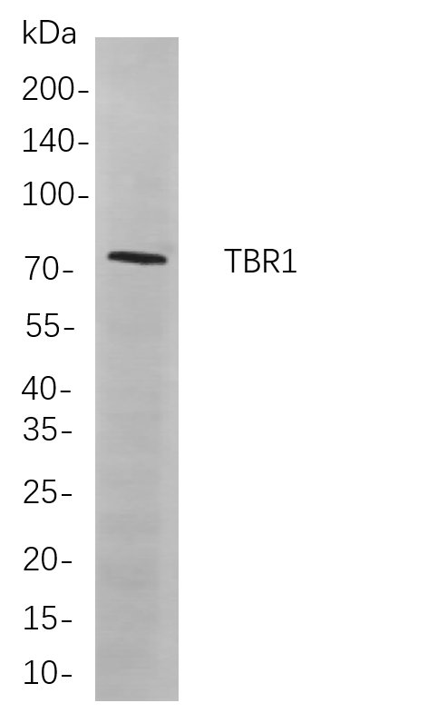 Recombinant TBR1 Monoclonal Antibody-searchlist-1