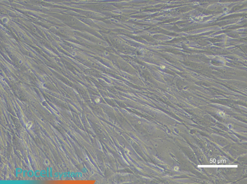 Human Pulmonary Arteriolar Smooth Muscle Cell Complete Medium - 6
