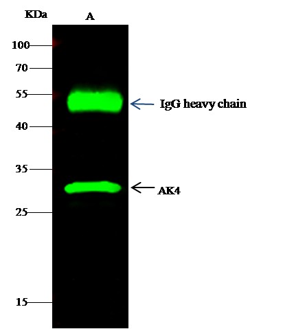Recombinant AK4/Adenylate Kinase 4/AK3L1 Monoclonal Antibody - small - 2