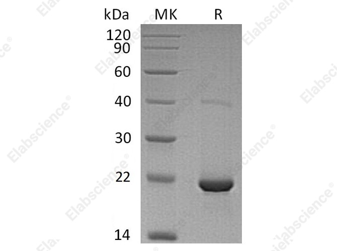 Recombinant Human dUTPase Protein (His Tag) - 1