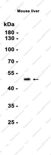 Recombinant ASS1 Monoclonal Antibody - 1