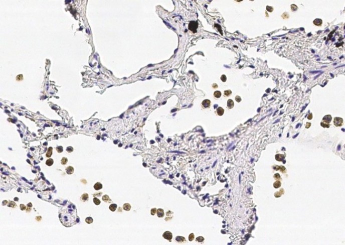 Recombinant COMMD9 Monoclonal Antibody - small - 2