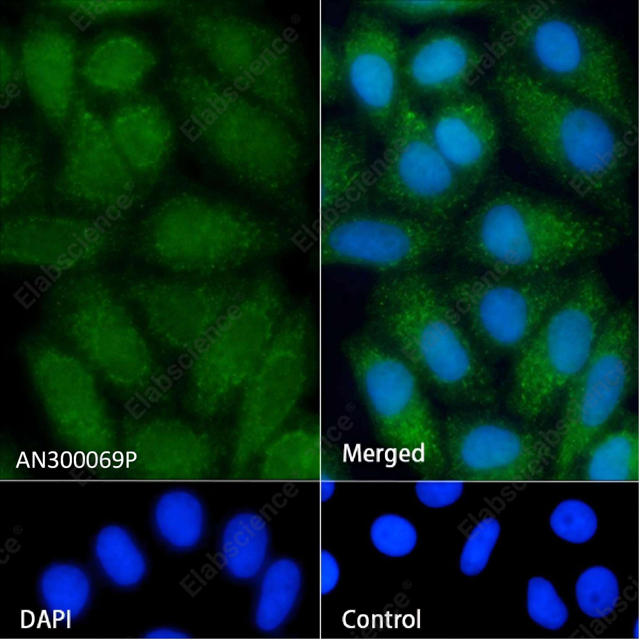 Recombinant ALDH7A1 Monoclonal Antibody - 5