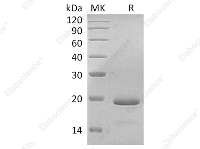 Recombinant Human Interleukin-11/IL-11 Protein - 1