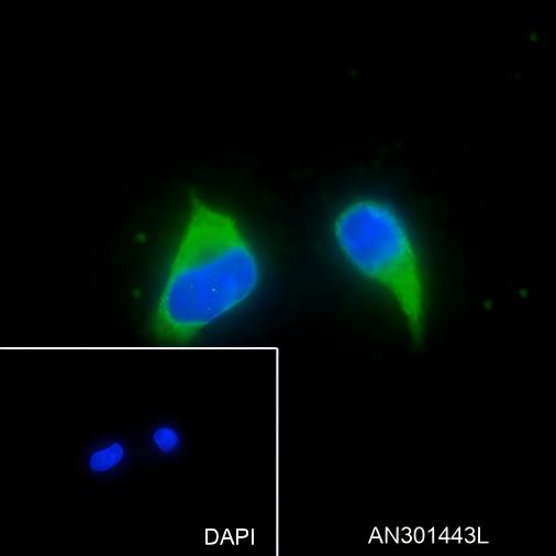 Recombinant BAP31 Monoclonal Antibody - 3