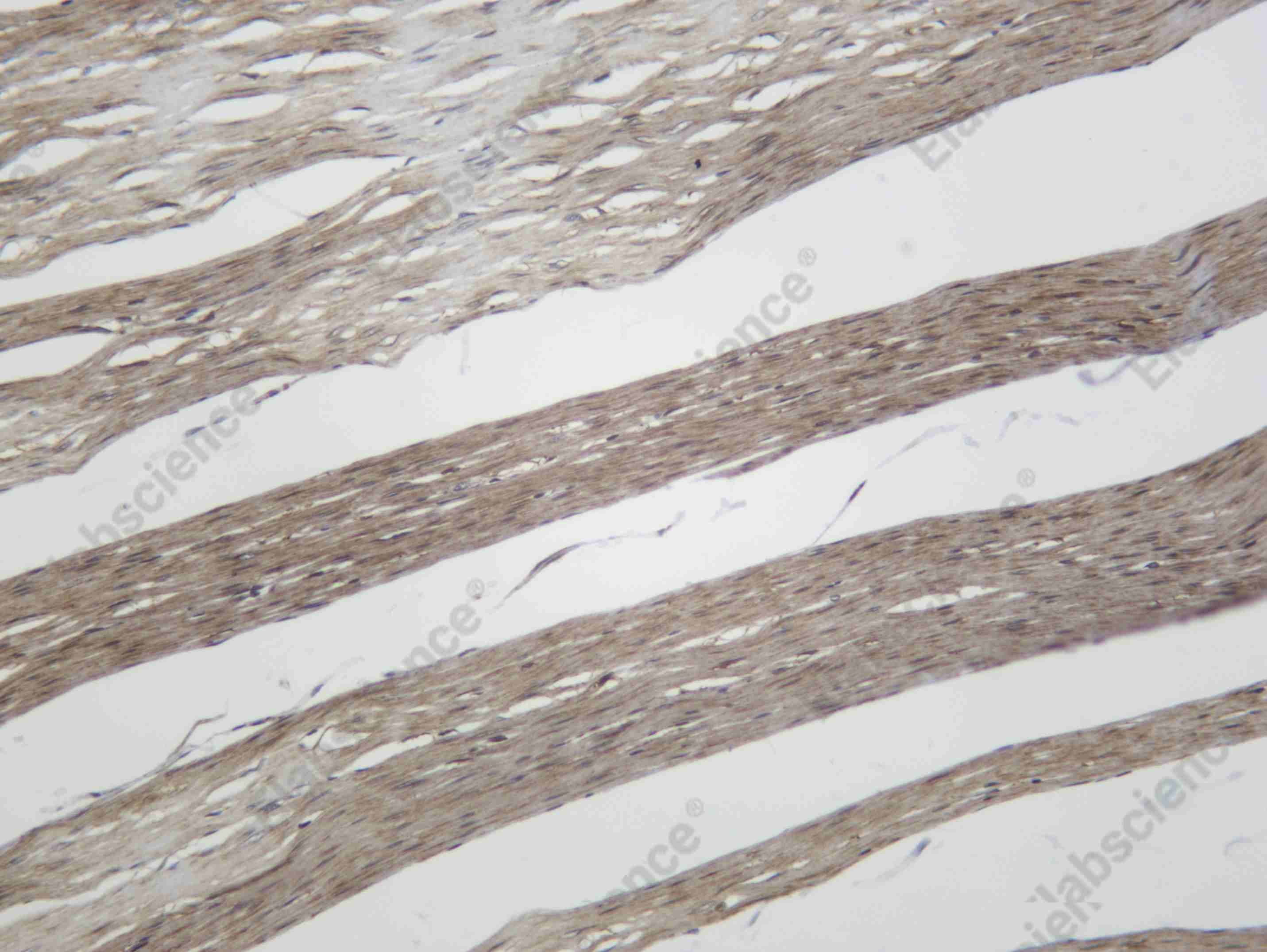 Recombinant Muscarinic Acetylcholine Receptor M2 Monoclonal Antibody - 1