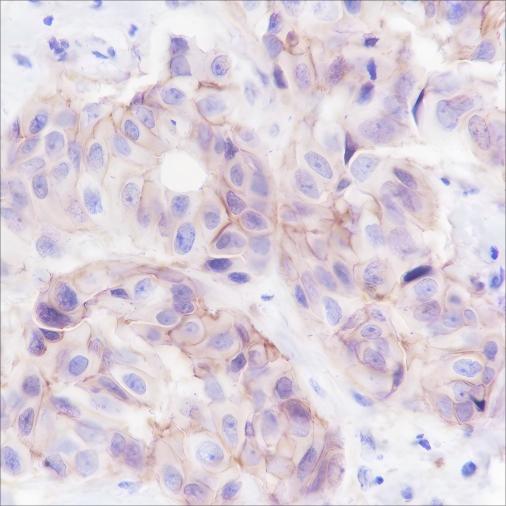 Recombinant EphA2 Monoclonal Antibody - small - 2