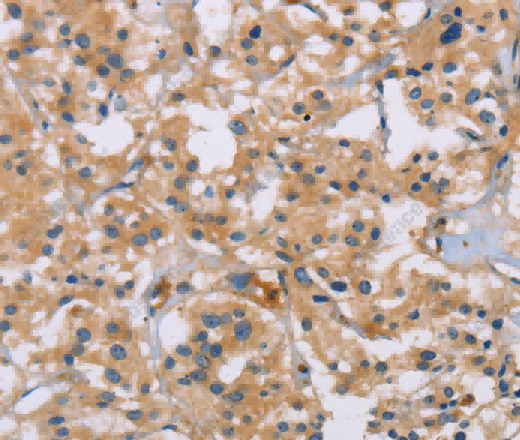 ACTN4 Polyclonal Antibody - 3
