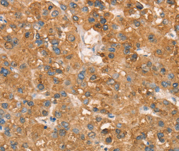CD297 Polyclonal Antibody - 2