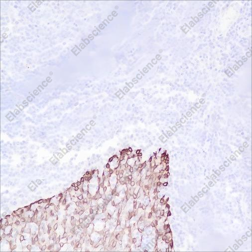 Recombinant Keratin 16 Monoclonal Antibody - 3