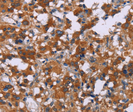 ERK1/2 Polyclonal Antibody - 2