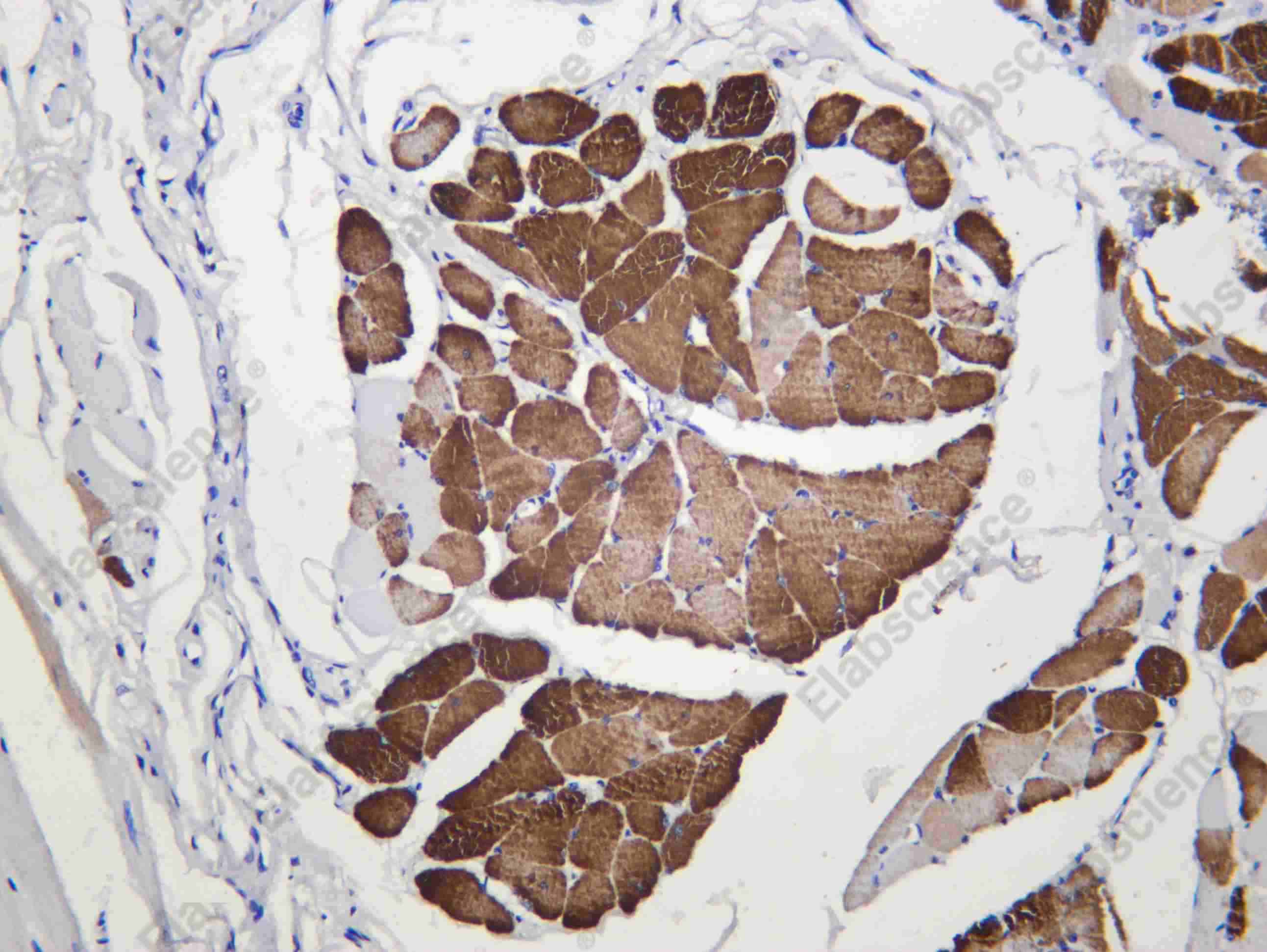 Recombinant MYL3 Monoclonal Antibody - 2