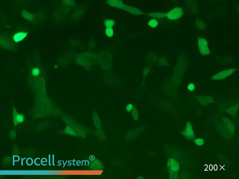 MC38-GFP - 4