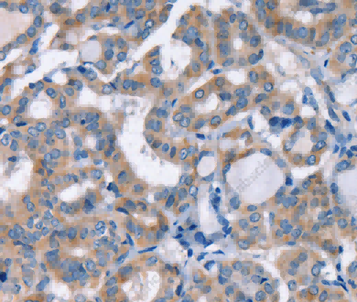 KCNQ5 Polyclonal Antibody - 2