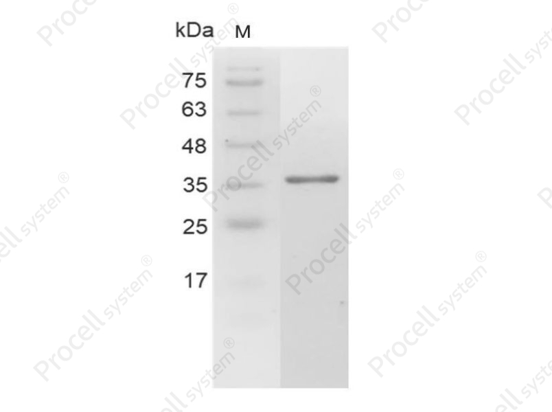 Galectin-4/LGALS4/GAL4/L36LBP, Human, Recombinant