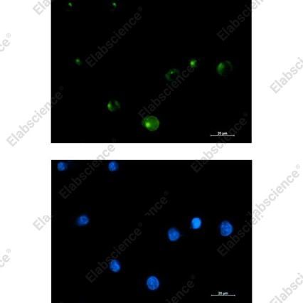 Recombinant FGFR1 Oncogene Partner Monoclonal Antibody - 1