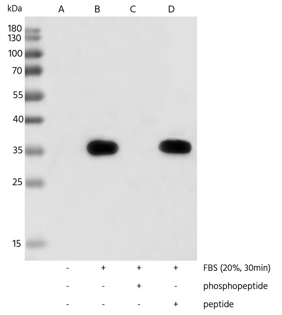 Recombinant Phospho-S6 Ribosomal Protein (Ser240, 244) Monoclonal Antibody - small - 5