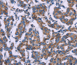 AGFG1 Polyclonal Antibody - 2