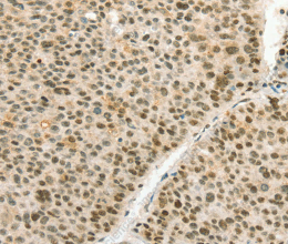 ANGPT4 Polyclonal Antibody - 2