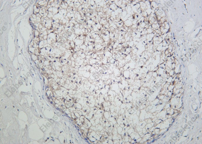 Recombinant GPX1 Monoclonal Antibody - 2