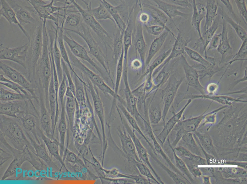 Human Synovial Fibroblast Complete Medium - 6