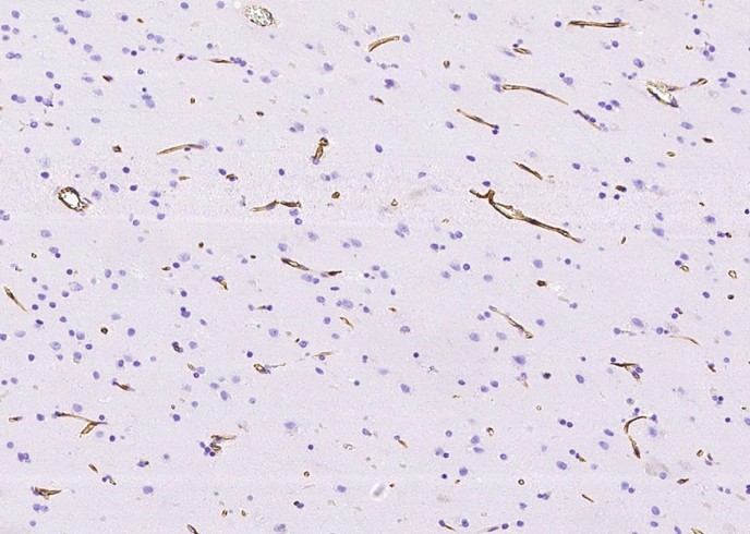 Nestin/NES Monoclonal Antibody-searchlist-1