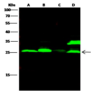 Recombinant Cathepsin L1/CTSL1 Monoclonal Antibody-searchlist-1