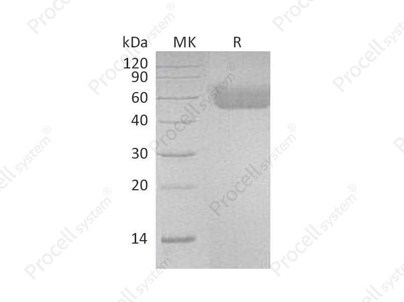 IL-1R-1/CD121a, Human, Recombinant