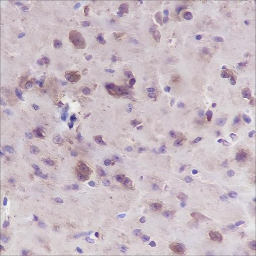 Recombinant Muscarinic Acetylcholine Receptor 2/CM2 Monoclonal Antibody - 3