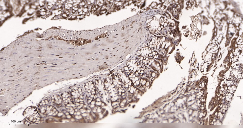 Recombinant TATA Box Binding Protein Monoclonal Antibody - small - 3