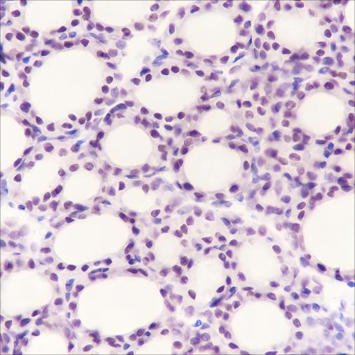 Recombinant PAX8 Monoclonal Antibody - 3