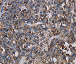 LBR Polyclonal Antibody - 2