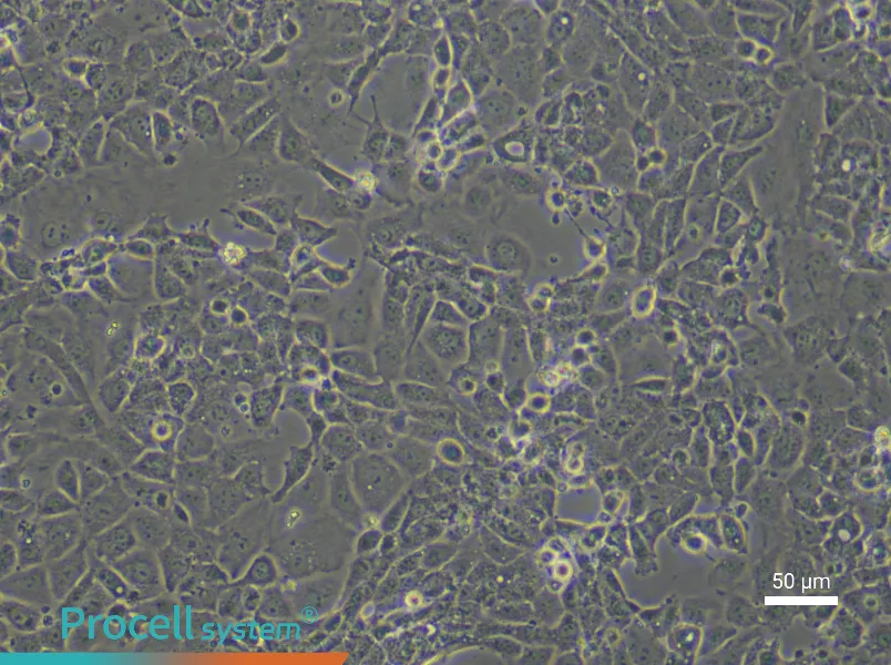 Rat Coronary Artery Endothelial Cells - 6