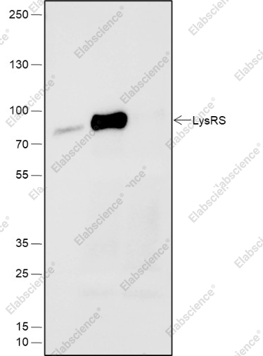 Recombinant LysRS Monoclonal Antibody - 6
