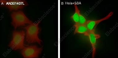 Recombinant Histone H3 (Acetyl Lys4) Monoclonal Antibody - 4