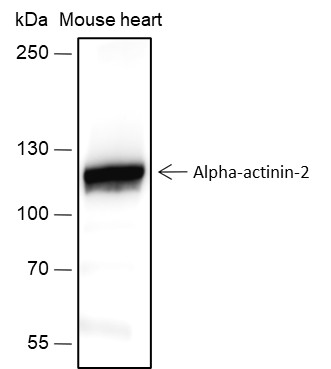Recombinant alpha Actinin 2 Monoclonal Antibody-searchlist-1