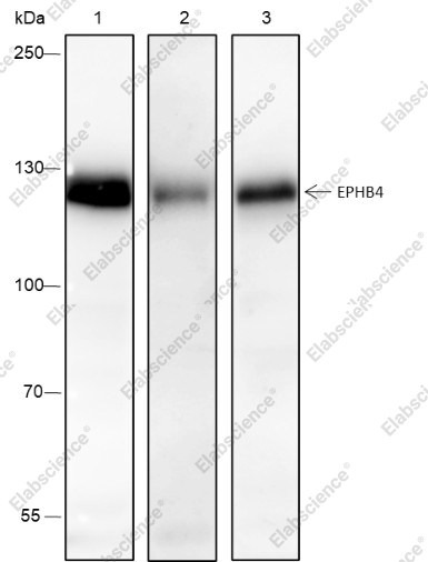 Recombinant EPHB4 Monoclonal Antibody - 1