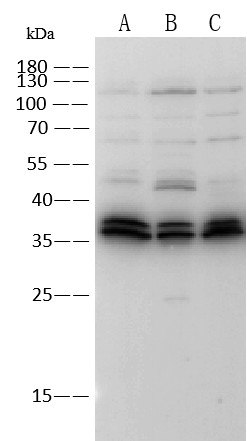 Recombinant TROP-2/TACSTD2 Monoclonal Antibody-searchlist-1