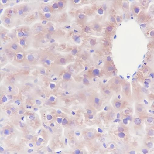 Recombinant GOT2 Monoclonal Antibody - 3